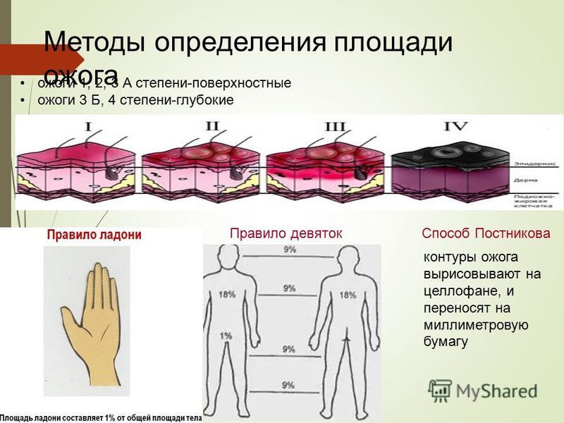 Клинические проявления ожогов 1 степени. Ожоги 3 степени тяжести термических. Признаки термического ожога 3 степени. Клинические проявления термического ожога II степени:.